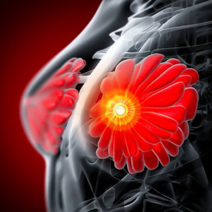 وبینار آموزشی جراحی پستان