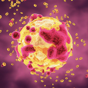 وبینار آموزشی جراحی سارکوم